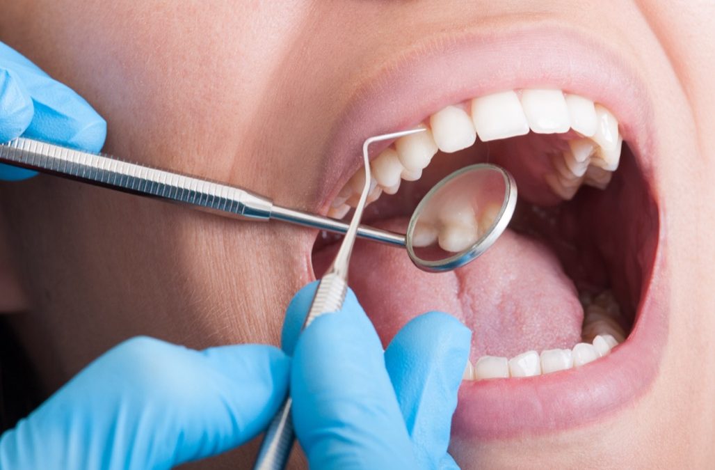 Dental Exam and Cleaning Near Me in Lancaster