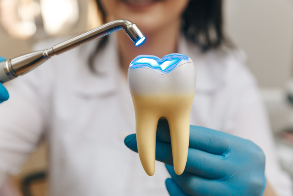 Process,Of,Filling,On,Fake,Tooth.