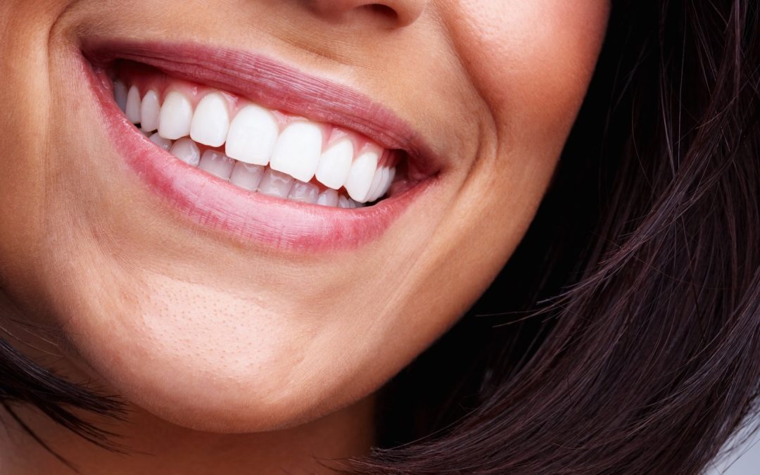 Teeth Cleaning & Exam in Lancaster, CA